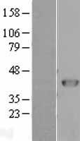 ARA9 (AIP) (NM_003977) Human Over-expression Lysate