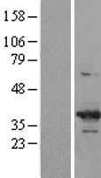 CDK6 (NM_001259) Human Over-expression Lysate