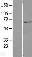 GAD67 (GAD1) (NM_000817) Human Over-expression Lysate