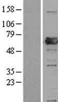 PRPF31 (NM_015629) Human Over-expression Lysate