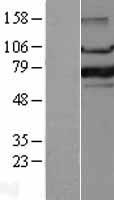 FOXP1 (NM_032682) Human Over-expression Lysate