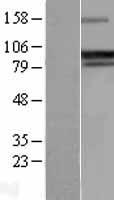 GADD34 (PPP1R15A) (NM_014330) Human Over-expression Lysate