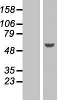 PAX6 (NM_001604) Human Over-expression Lysate