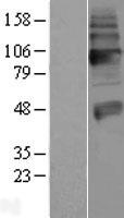 Vesicular Acetylcholine Transporter (SLC18A3) (NM_003055) Human Over-expression Lysate