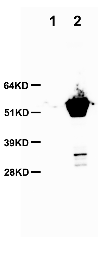 SARS-CoV-2 N Protein (NC_045512) Virus Over-expression Lysate