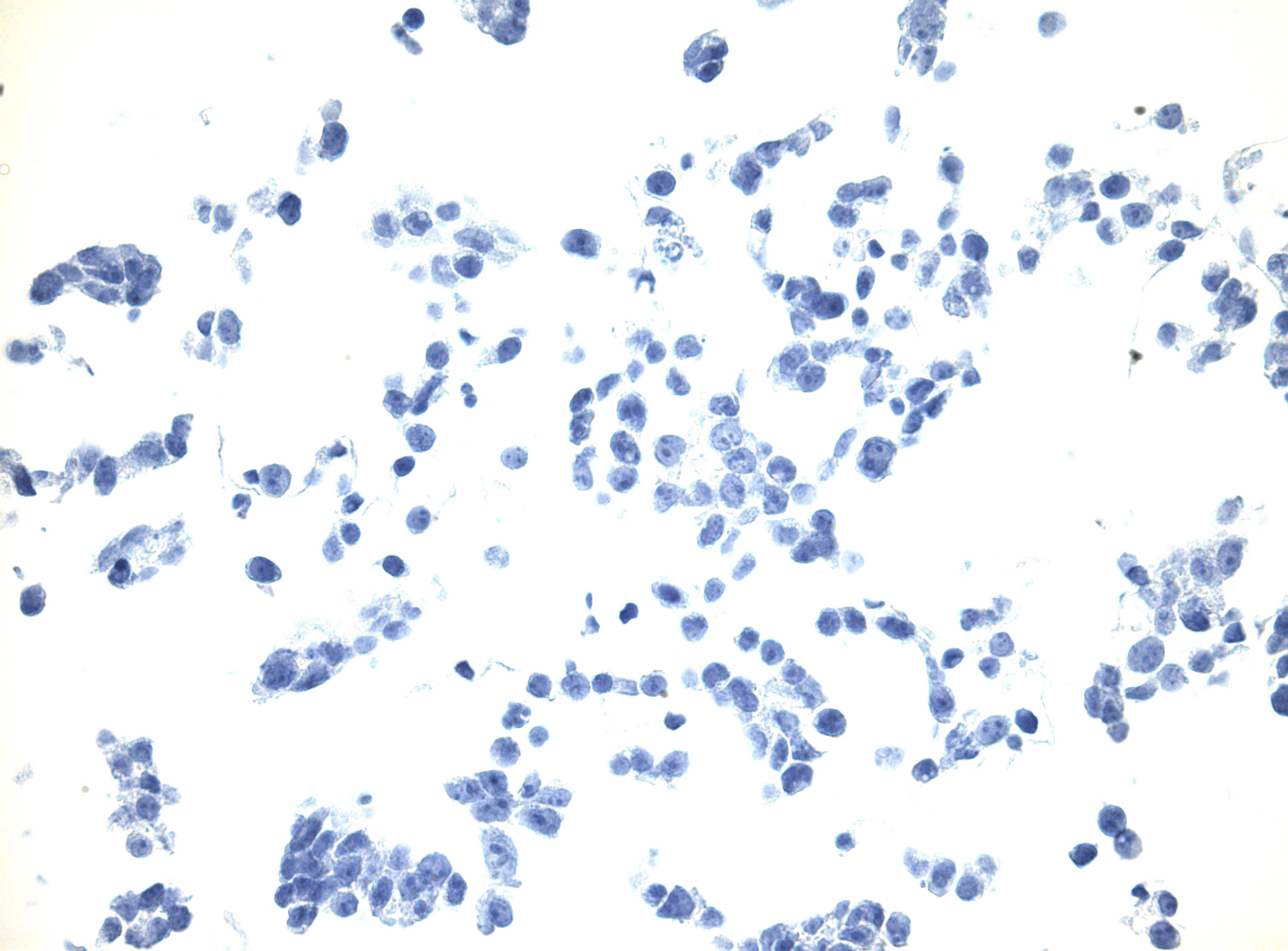 HEK293T Cells Un-transfected Negative Control