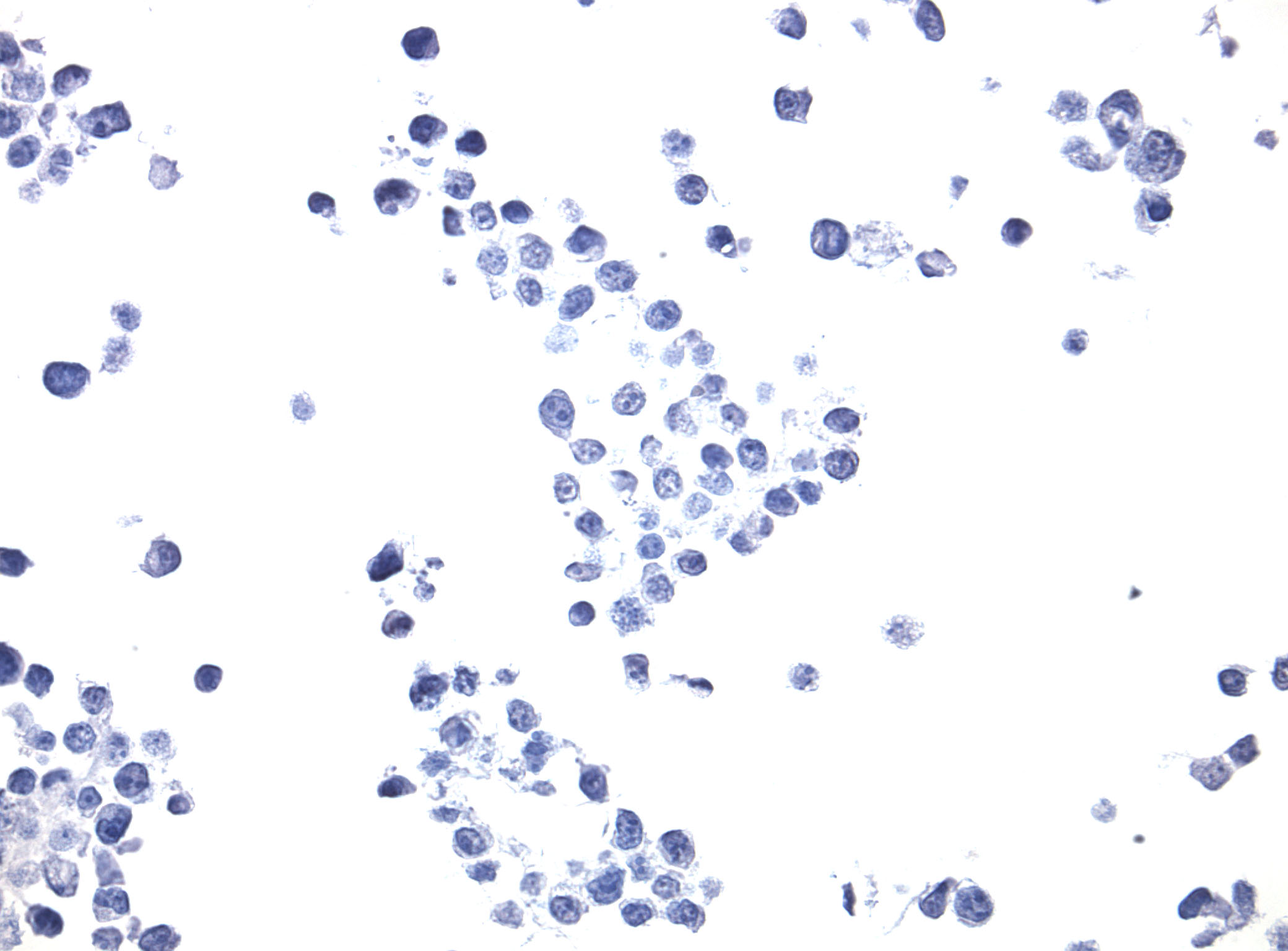 HEK293T Cells Un-transfected Negative Control