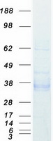 EPCAM (NM_002354) Human Recombinant Protein