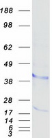 Bone marrow stromal cell antigen 1 (BST1) (NM_004334) Human Recombinant Protein