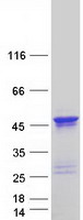 Doublecortin (DCX) (NM_178153) Human Recombinant Protein