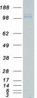 ROR2 (NM_004560) Human Recombinant Protein