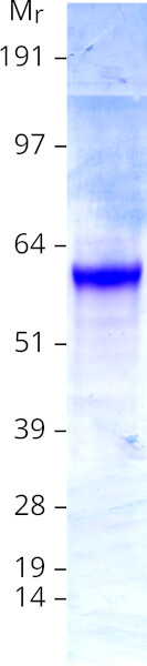 TRAF6 (NM_004620) Human Recombinant Protein