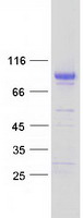 MFRP (NM_031433) Human Recombinant Protein