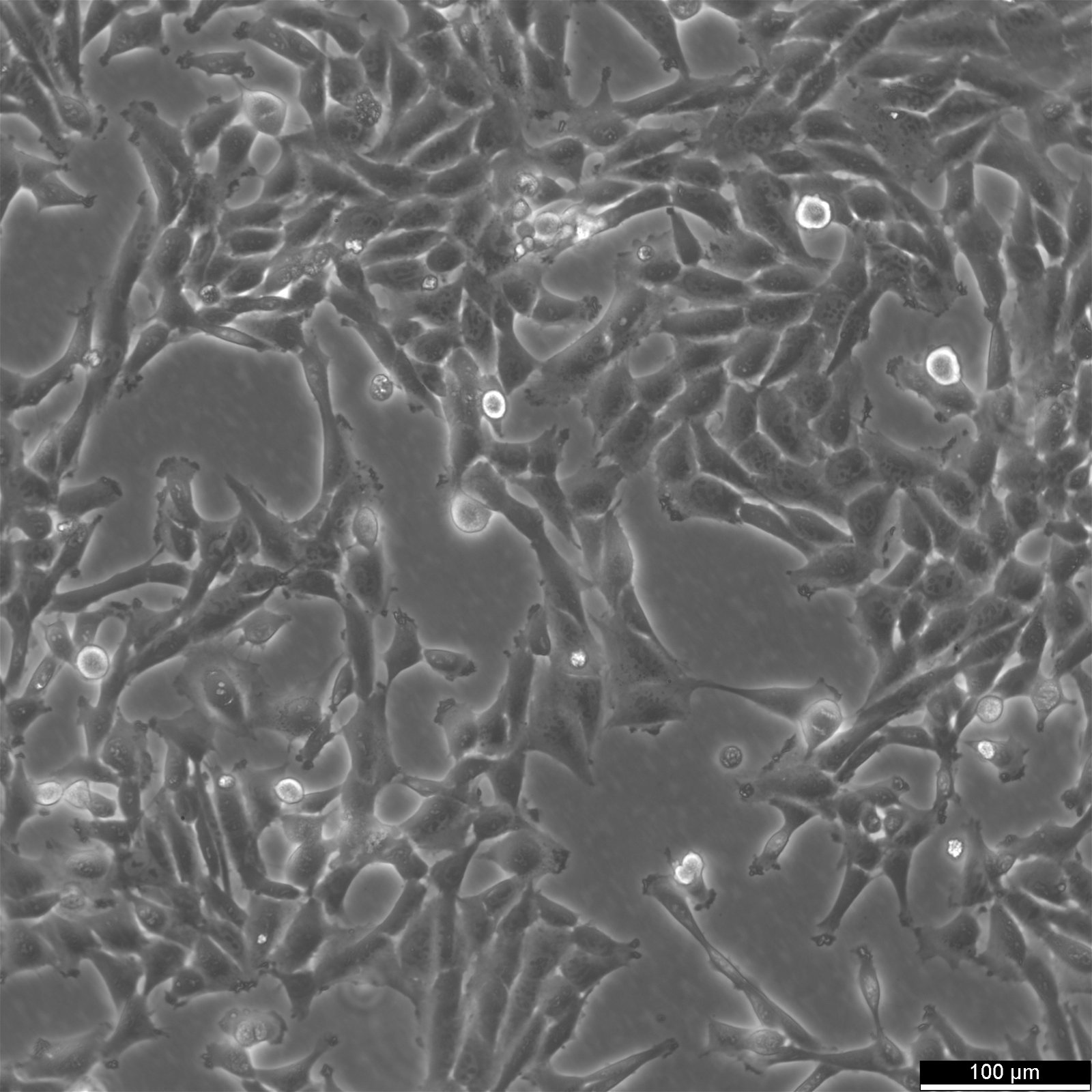SUM159PT Cells