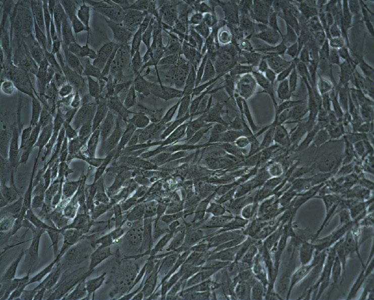 SK-LMS-1 Cells