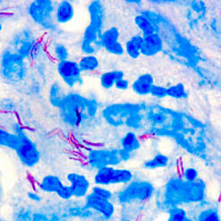 Human lung stained with Fite kit (KT013)