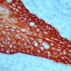 Formalin fixed paraffin embedded human tonsil stained with high molecular weight Cytokeratin H.M.W and labeled with Mono AEC/ Plus (K050).