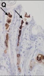 Sebaceous gland abnormalities in fatty acyl CoA reductase 2 (Far2) null mice result in primary cicatricial alopecia.