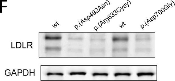 Mutation type classification and pathogenicity assignment of sixteen missense variants located in the EGF-precursor homology domain of the LDLR.