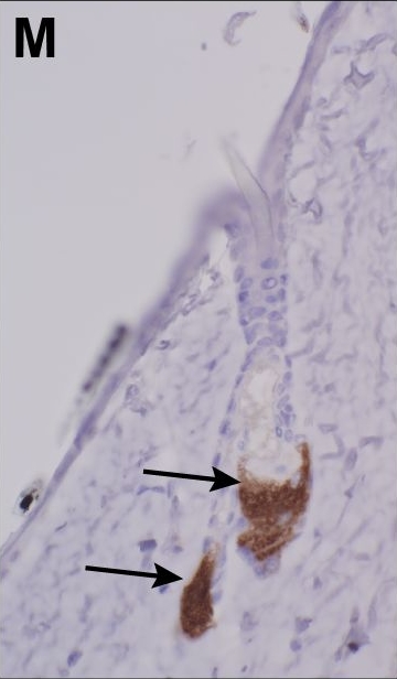 Sebaceous gland abnormalities in fatty acyl CoA reductase 2 (Far2) null mice result in primary cicatricial alopecia.