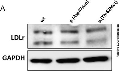 p.(Asp47Asn) and p.(Thr62Met): non deleterious LDL receptor missense variants functionally characterized in vitro.