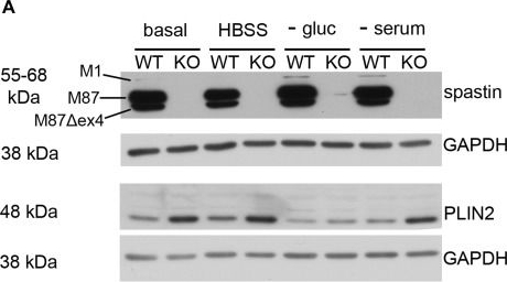 Microtubule-dependent and independent roles of spastin in lipid droplet dispersion and biogenesis.