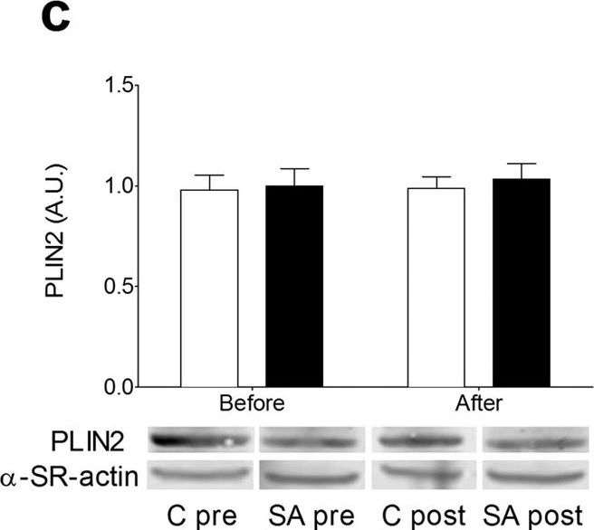 Lipid droplet dynamics and insulin sensitivity upon a 5-day high-fat diet in Caucasians and South Asians.