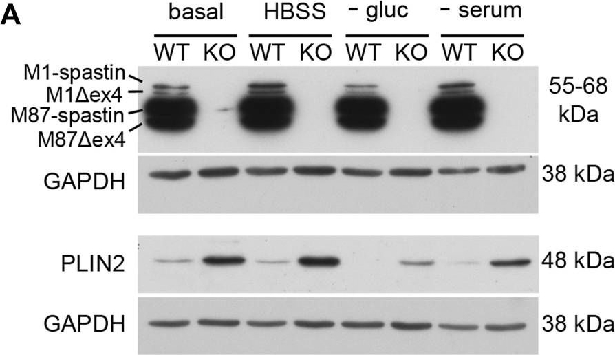 Microtubule-dependent and independent roles of spastin in lipid droplet dispersion and biogenesis.