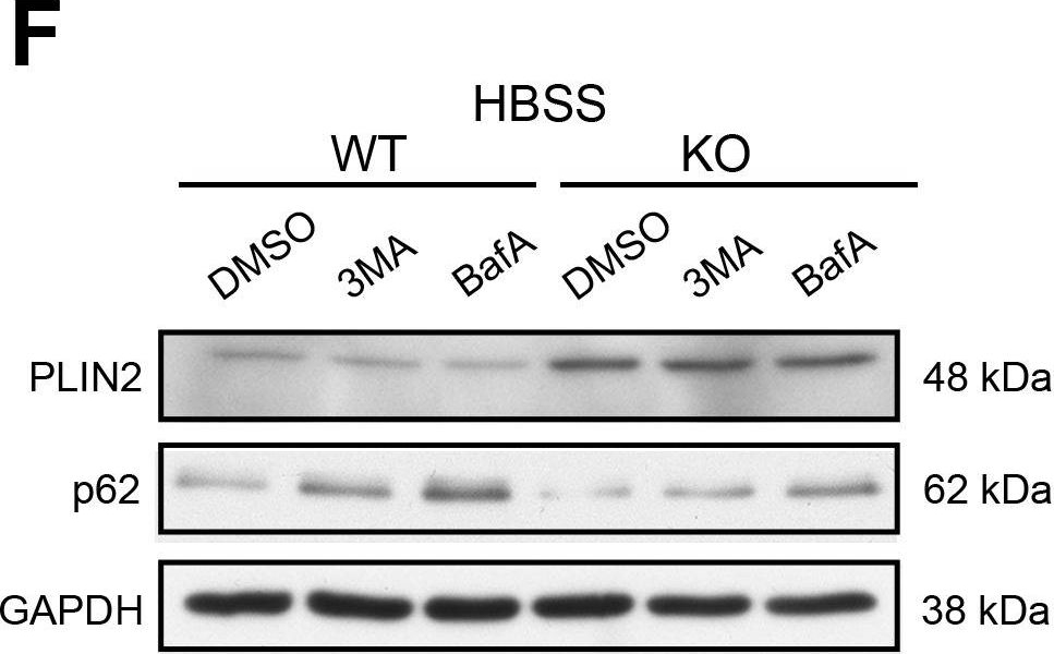 Microtubule-dependent and independent roles of spastin in lipid droplet dispersion and biogenesis.