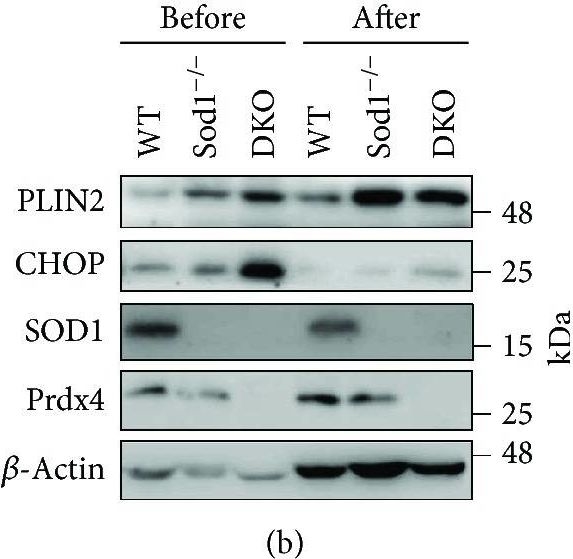 Double Knockout of Peroxiredoxin 4 (Prdx4) and Superoxide Dismutase 1 (Sod1) in Mice Results in Severe Liver Failure.