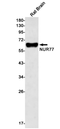 Figure 1. Recombinant Rabbit Anti-NR4A1 Antibody (clone R02-1C7) in WB.
