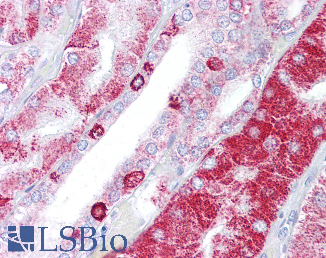 ACAT1 Antibody - Anti-ACAT1 antibody IHC of human kidney. Immunohistochemistry of formalin-fixed, paraffin-embedded tissue after heat-induced antigen retrieval. Antibody concentration 10 ug/ml.