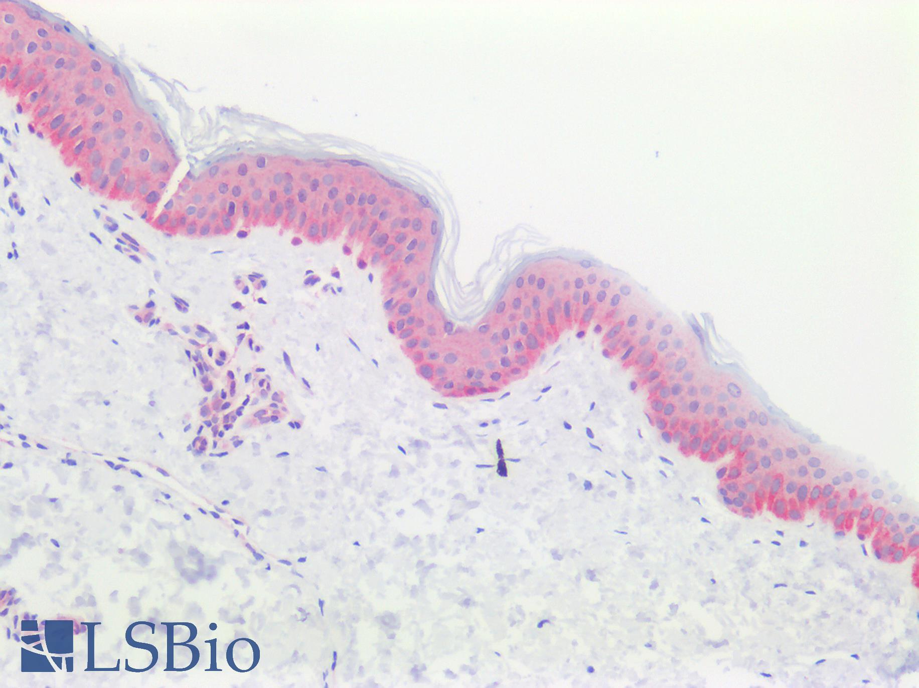 PVRL4 / Nectin 4 Antibody - Human Skin: Formalin-Fixed, Paraffin-Embedded (FFPE)