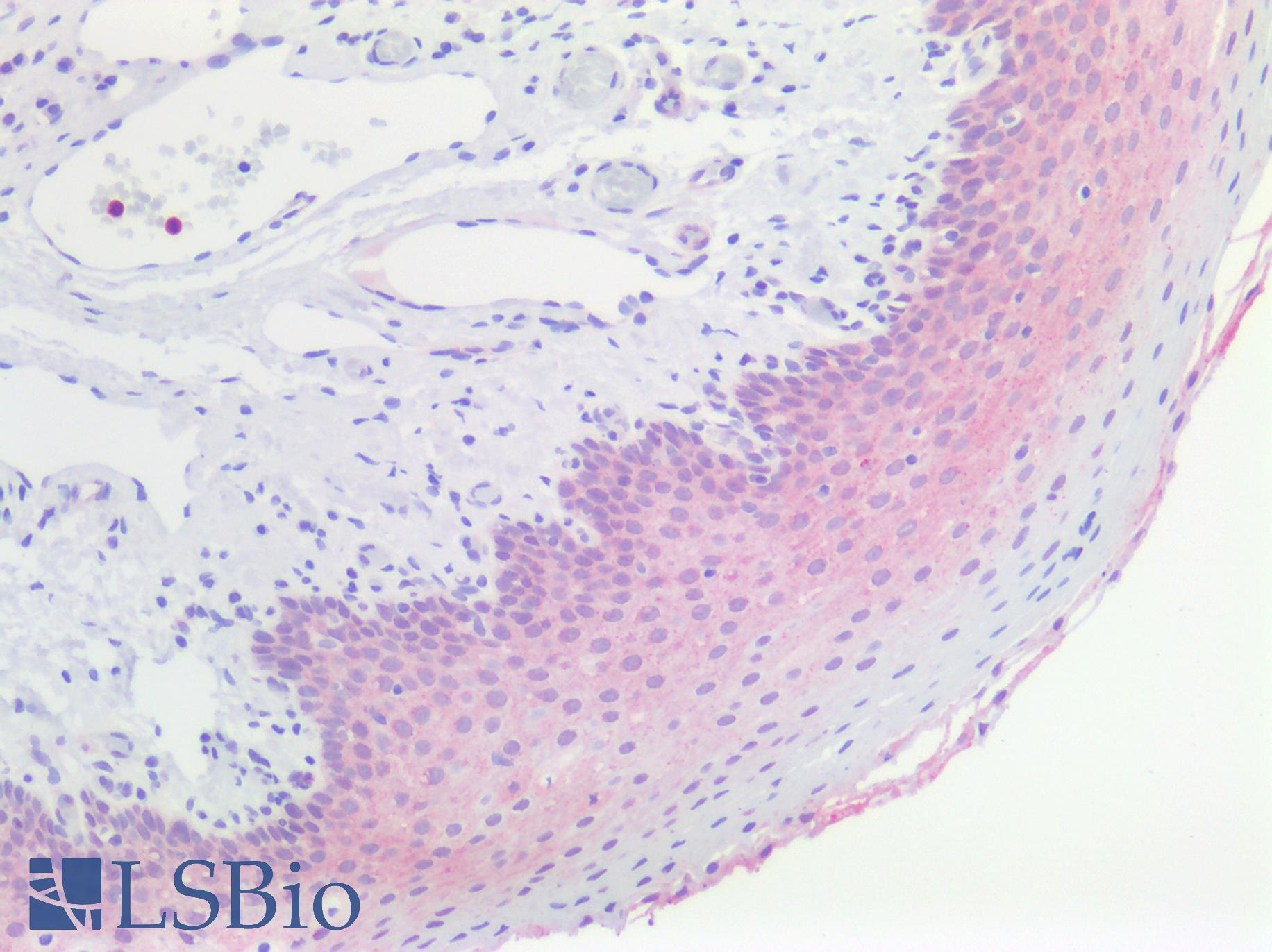 PVRL4 / Nectin 4 Antibody - Human Tonsil Squamous: Formalin-Fixed, Paraffin-Embedded (FFPE)