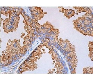 Cytokeratin 8 (C51): sc-8020. Immunoperoxidase staining of formalin fixed, paraffin-embedded... 