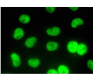 EWS (C-9): sc-48404. Immunofluorescence detection of EWS in formalin-fixed... 