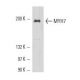 MYH7 Antibody (6D592) - Western Blotting - Image 17608 