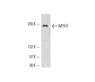 MYH7 Antibody (6D592) - Western Blotting - Image 17608 