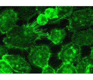 TDE2L (E-18): sc-138678. Immunofluorescence staining of formalin-fixed A-431... 