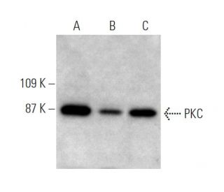 PKC (H-300): sc-10800. Western blot analysis of PKC expression in 3611-RF (A), HeLa (B) and NIH/3T3 (C) whole cell lysates 