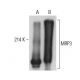 MRP3 Antibody (B-2) - Western Blotting - Image 399350