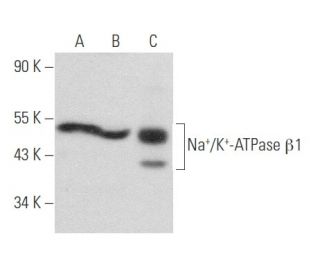 beta 1 Sodium Potassium ATPase/ATP1B1 Antibody (464.8) - Western Blotting - Image 357656 