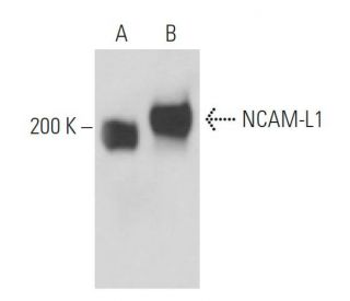 NCAM-L1 Antibody (74-5H7) - Western Blotting - Image 17063