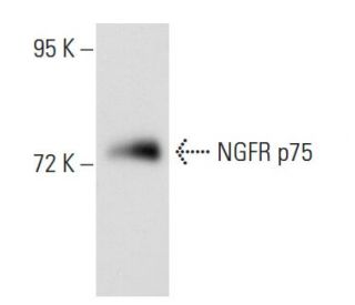 NGFR p75 Antibody (0.N.469) - Western Blotting - Image 53548