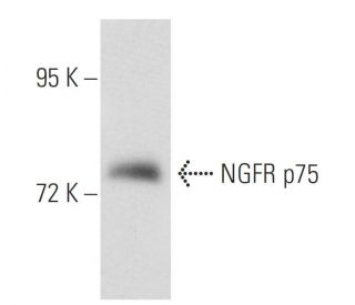 NGFR p75 Antibody (2B2.55) - Western Blotting - Image 53552