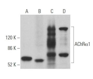 Nicotinic Acetylcholine Receptor alpha 1/CHRNA1 Antibody (153) - Western Blotting - Image 363544 