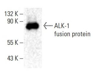 ALK-1 Antibody (F-1) - Western Blotting - Image 398506 