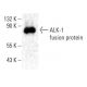 ALK-1 Antibody (F-1) - Western Blotting - Image 398506 