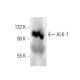 ALK-1 Antibody (F-1) - Western Blotting - Image 398507 