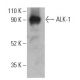 ALK-1 Antibody (F-1) - Western Blotting - Image 400695